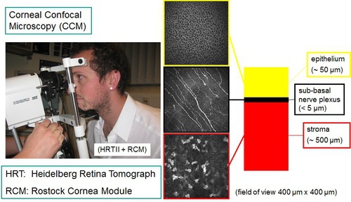 Cornea