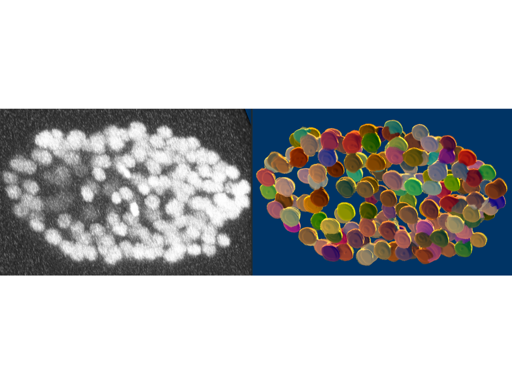 Erfolg bei der Cell Tracking Challenge