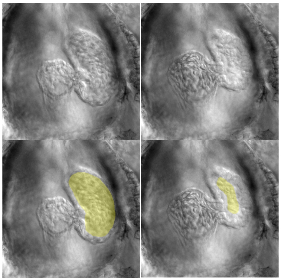 Zebrafish Heart Ventricel